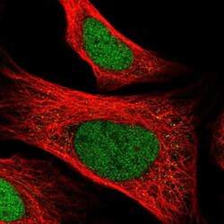 ZNF707 Antibody, Novus Biologicals 25 &mu;L, Unlabeled:Antibodies, Polyclonal